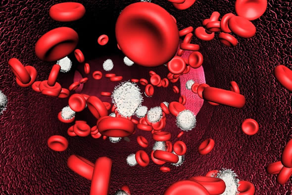 Anemia hemolítica por deficiencia de glucosa fosfato isomerasa