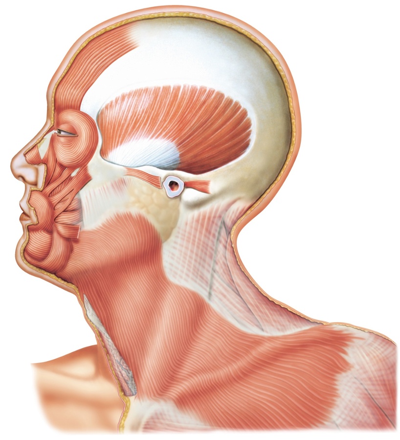 Cáncer de mama tipo glándula salivar