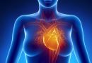 Cardiomiopatía histiocitoide