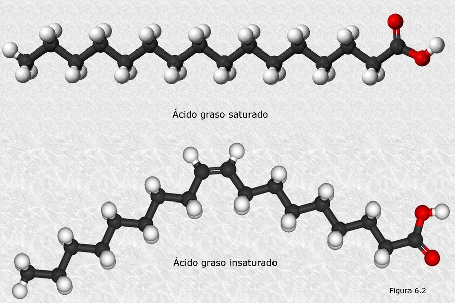 Deficiencia de carnitina palmitoiltransferasa II, forma infantil grave