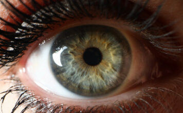 Glaucoma congénito