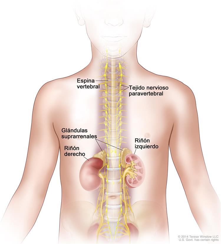 Ganglioneuroblastoma