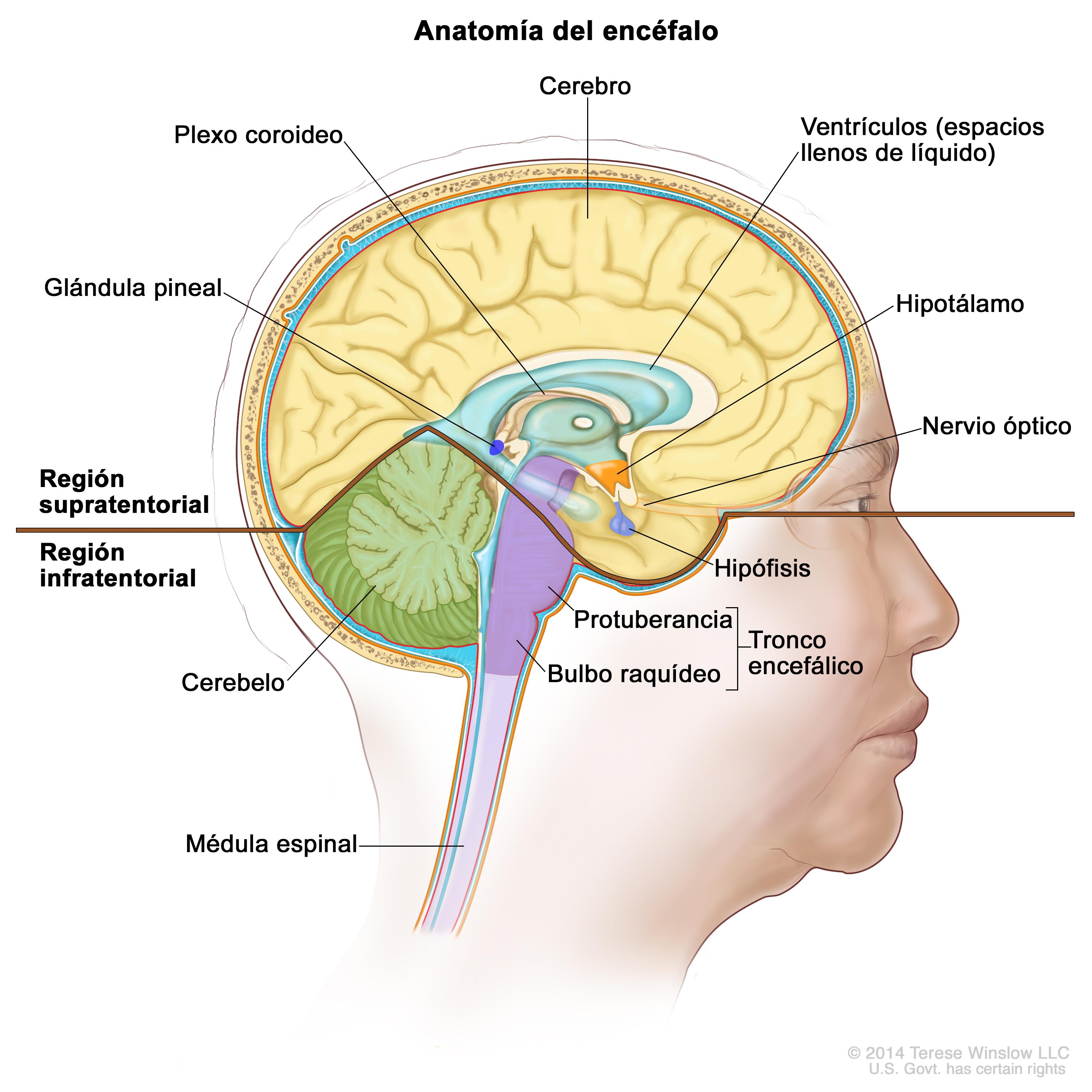 Glioma cordoide