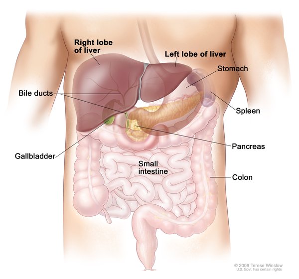 Amiloidosis ATTRV30M