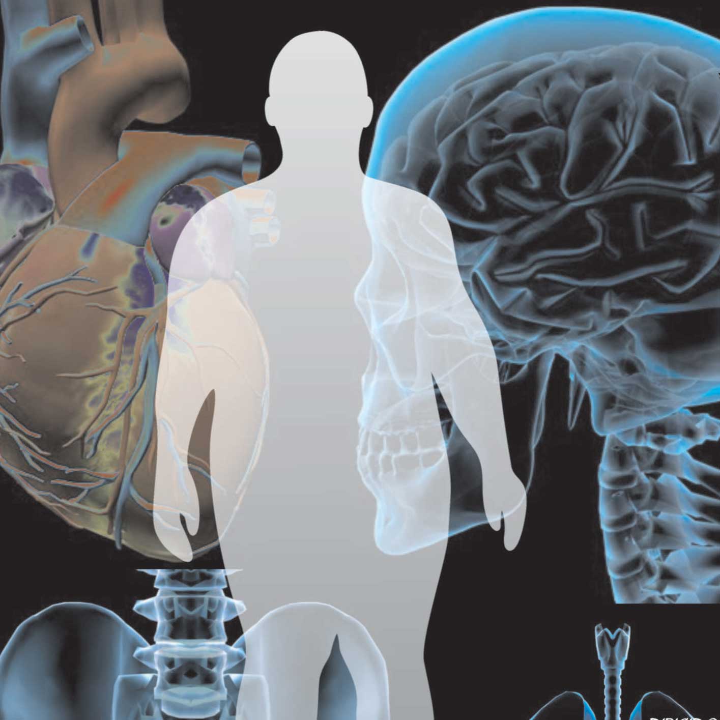 Deficiencia de 3-metilcrotonil-CoA carboxilasa