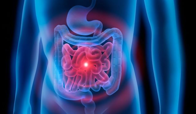 Mesenteritis asociada a IgG4