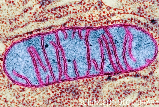 Neurodegeneración asociada a la proteína de membrana mitocondrial