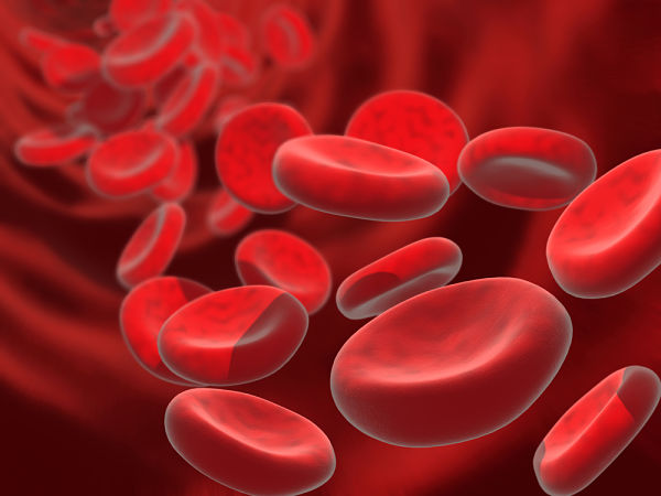 anemia hemolítica autoinmune