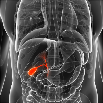 Carcinoma de vesícula y vías biliares extrahepáticas