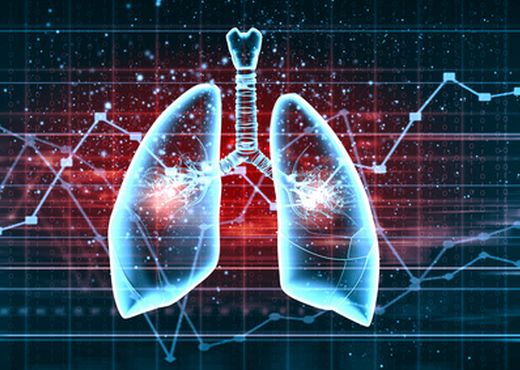 Enfermedad veno-oclusiva pulmonar y/o hemangiomatosis capilar pulmonar