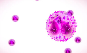 Neutropenia congénita grave