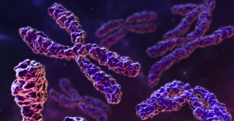 Hipocondroplasia FEMEXER