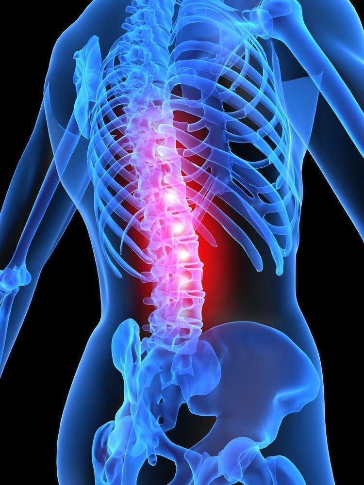 Síndrome de paraplejía espásitica - atrofia óptica - neuropatía