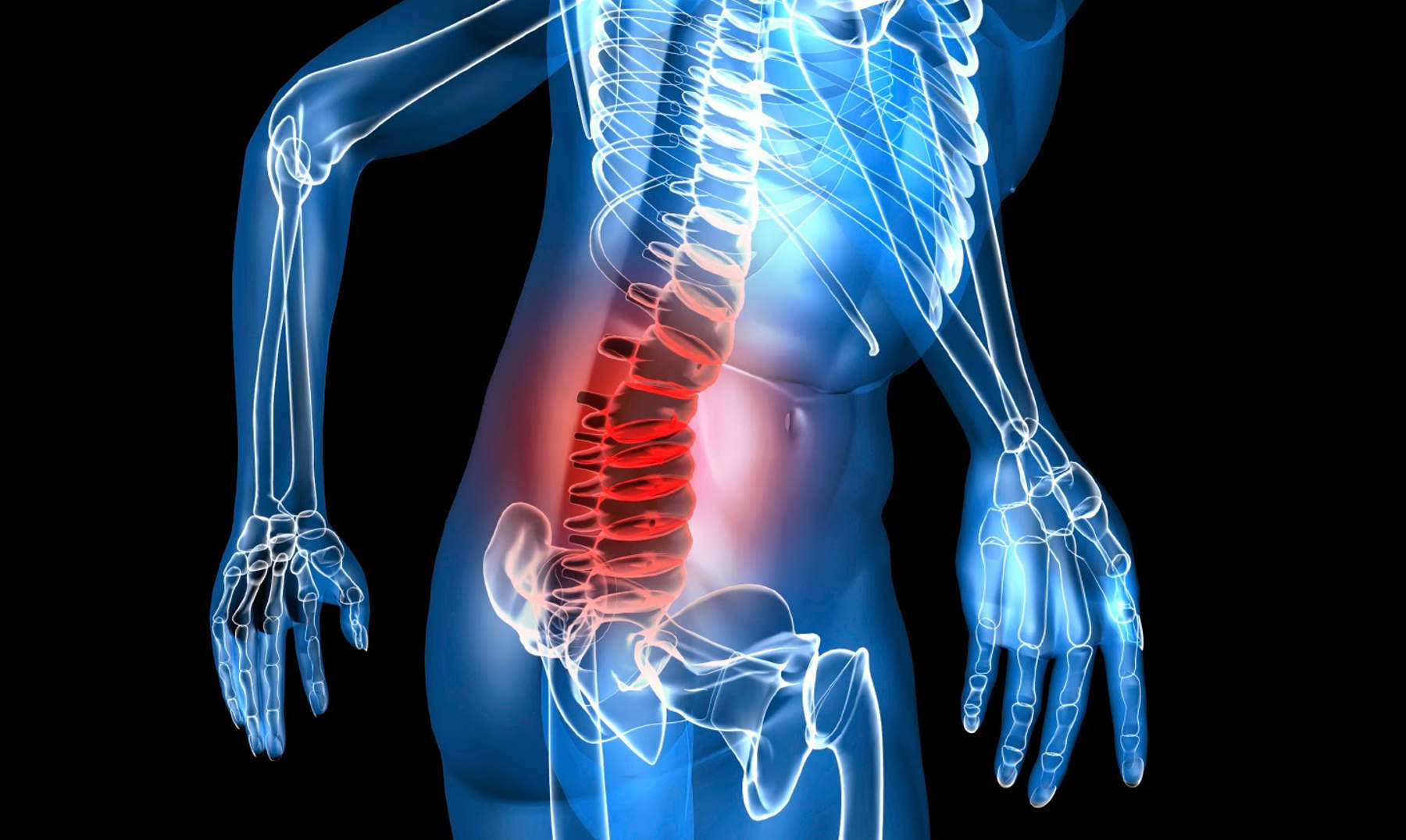 mieloma múltiple, daratumumab y hialuronidasa