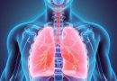 Enfermedad pulmonar micobacteriana