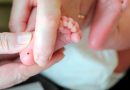 tamiz-neonatal
