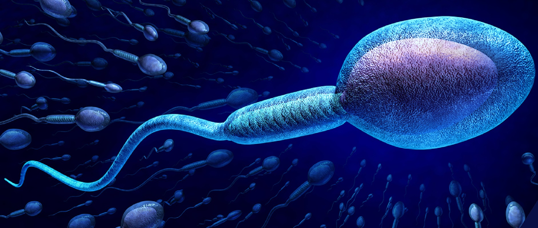 Infertilidad masculina con teratozoospermia por una única mutación genética