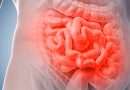 Insuficiencia-intestinal-cronica