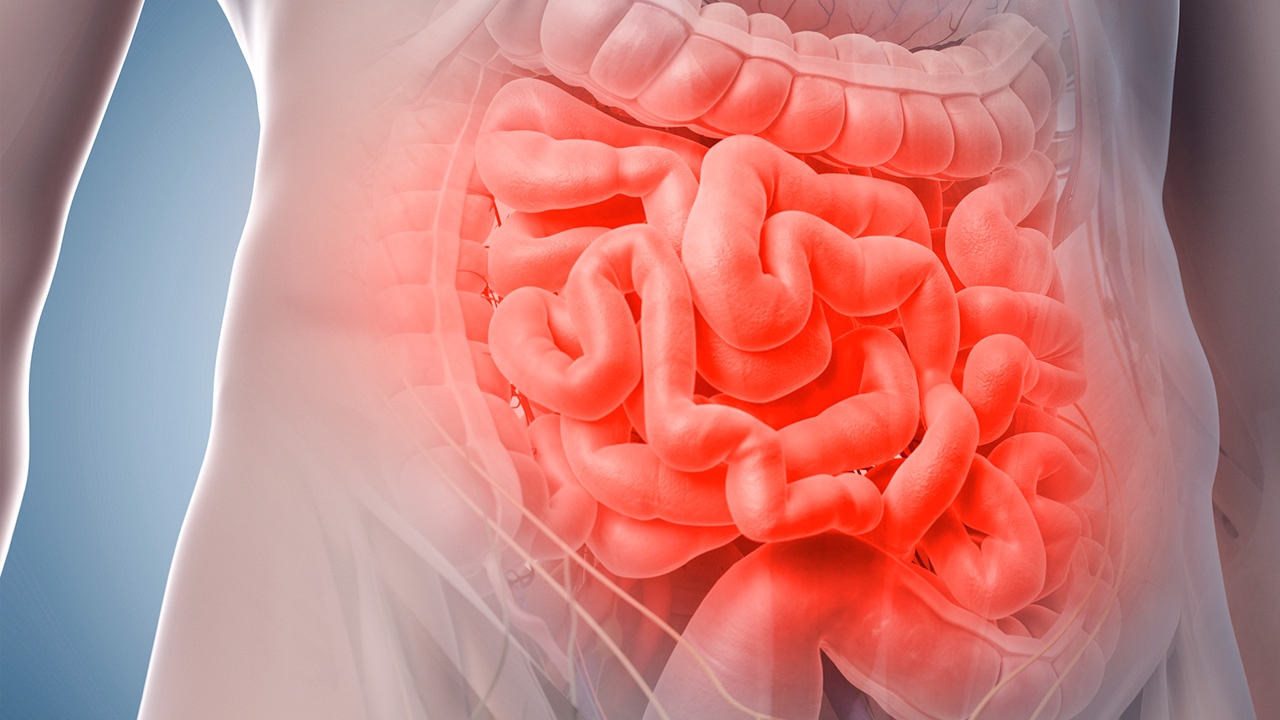 Insuficiencia intestinal crónica