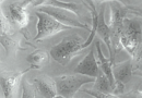 Osteosarcoma eerr