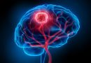 Glioblastoma-ebola