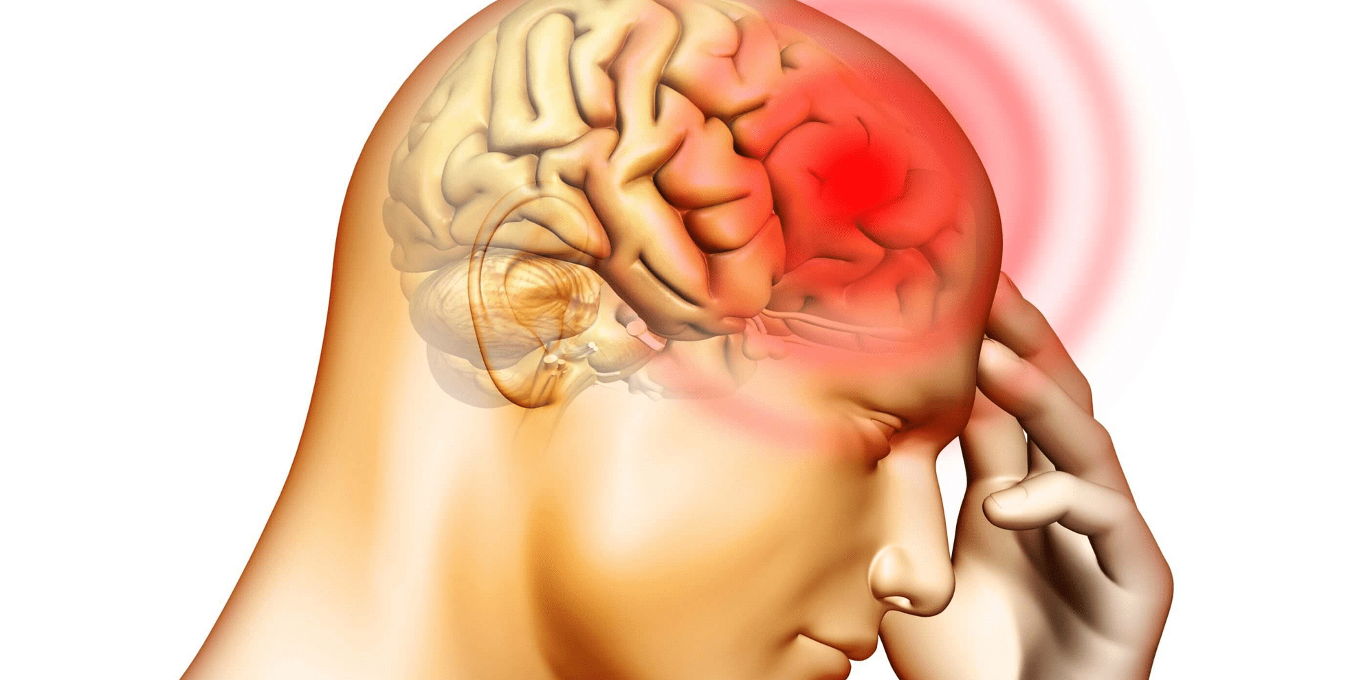 Meningitis meningocócica