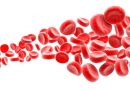 Terapia con células CAR-T en la leucemia linfocítica crónica