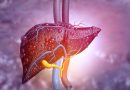 Cáncer de higado raro