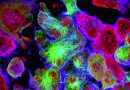 Neuroblastoma-proteina