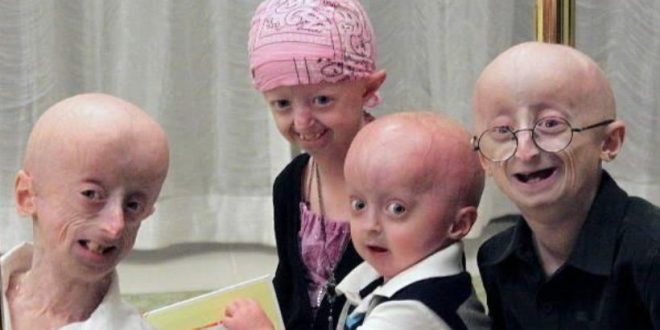 Dos terapias génicas aumentan la esperanza de vida en ratones con progeria
