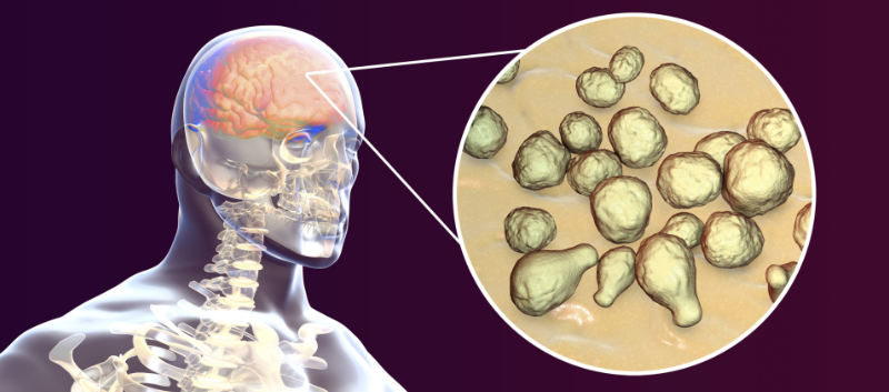 Nuevo tratamiento potencial para la criptococosis otorgada a una designación de fármaco huérfano