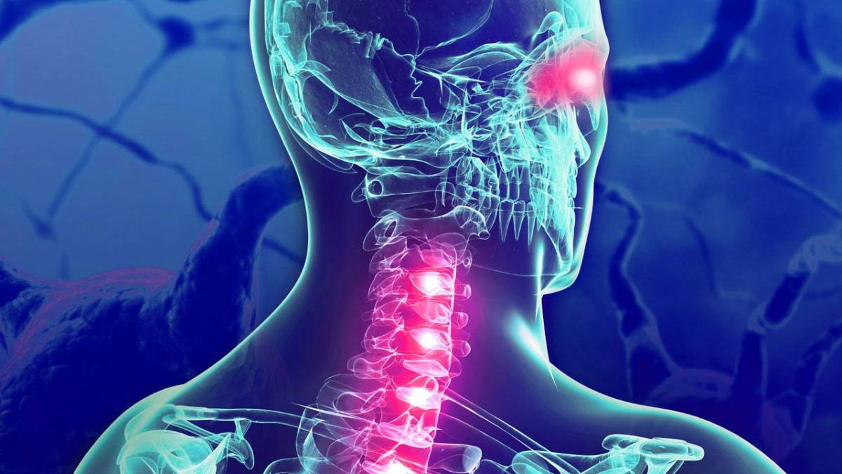 Efecto del tratamiento con interferón beta en la supervivencia de pacientes con esclerosis múltiple