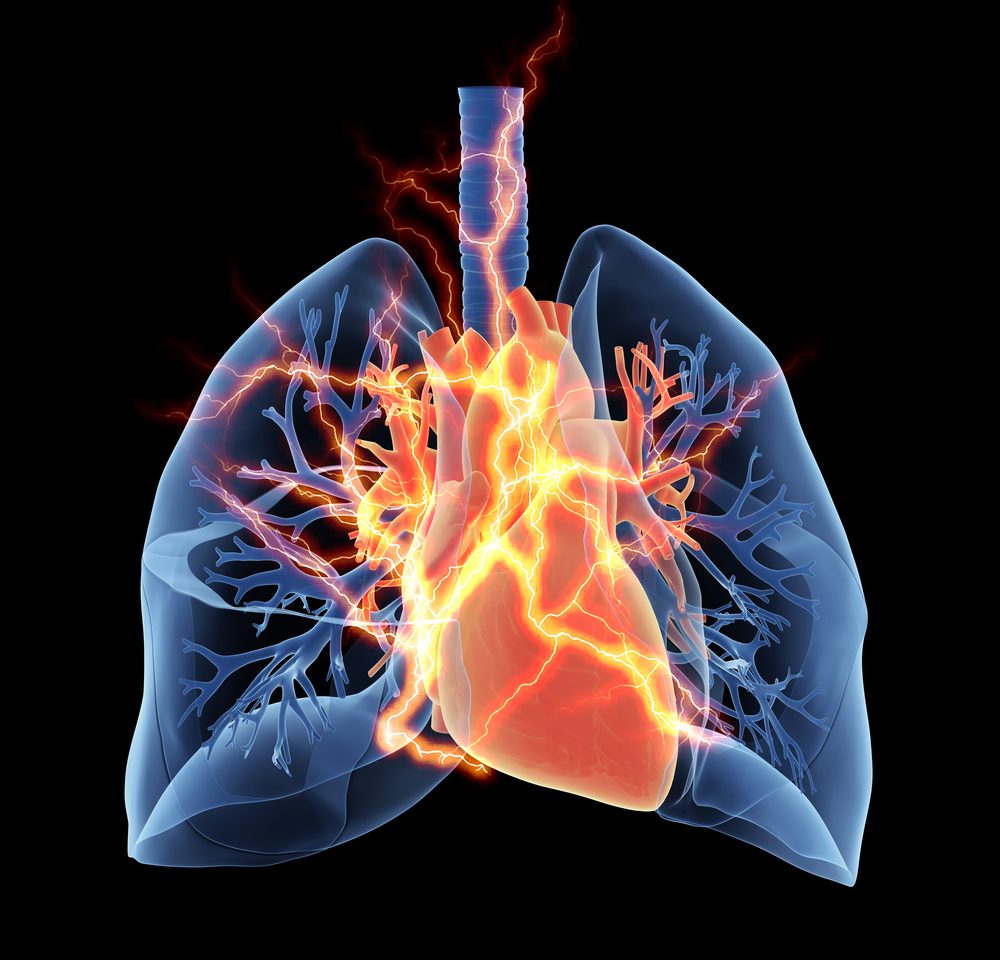 Un estudio sugiere que las tasas de supervivencia para el pH asociado con la enfermedad pulmonar son similares a la mala supervivencia en la HIP