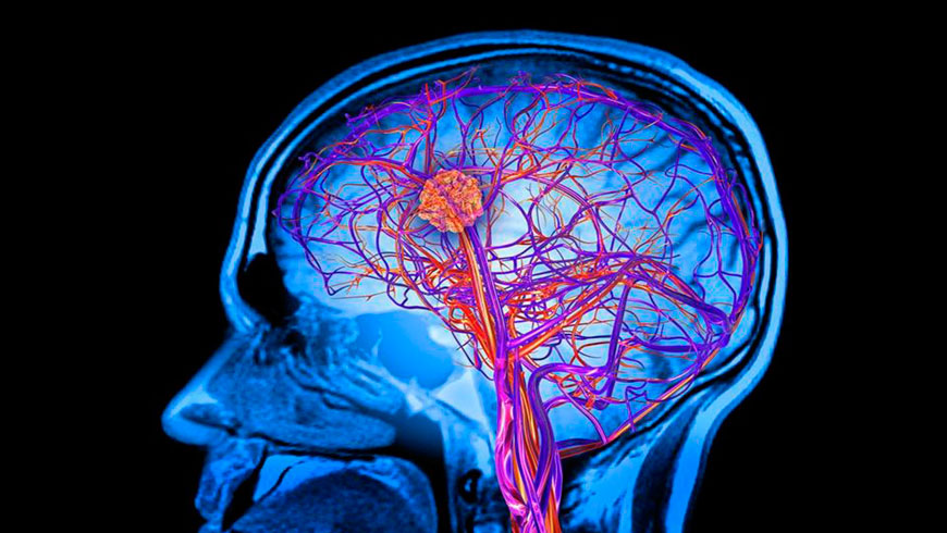 Anunciando una nueva prueba para una amplia gama de trastornos metabólicos raros