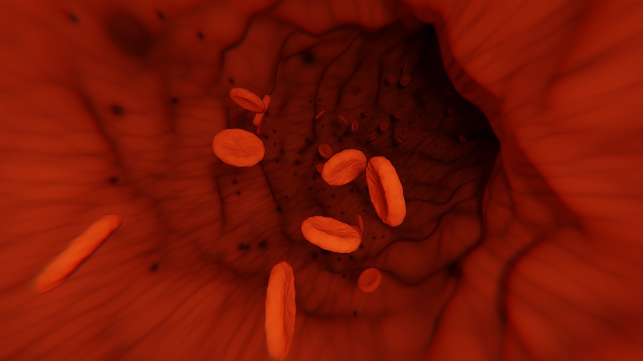 leucemia mieloide aguda, linfoma de células del manto