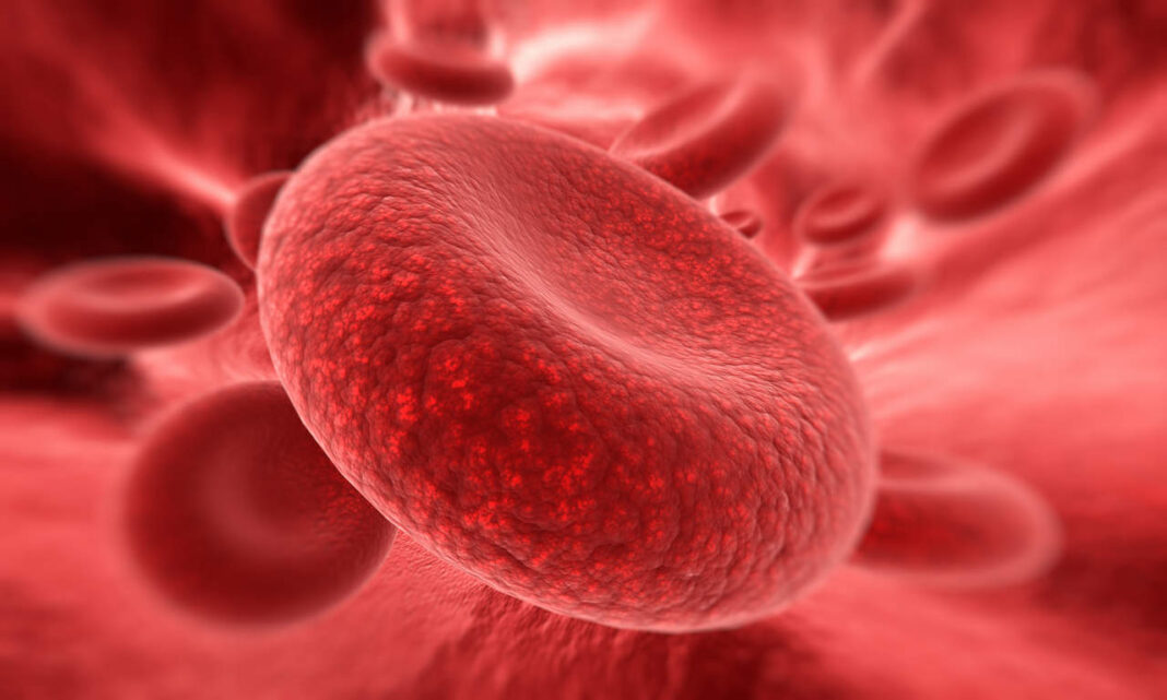 hemoglobinuria paroxística nocturna