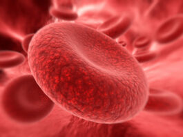 hemoglobinuria paroxística nocturna