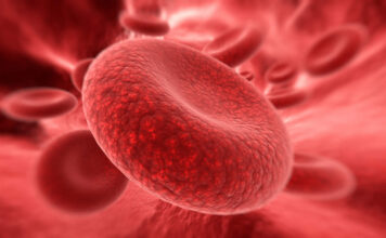 hemoglobinuria paroxística nocturna