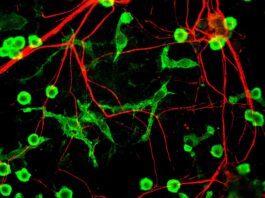 Microglía y neuronas