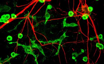 Microglía y neuronas