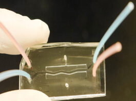 Pancreas chip y fibrosis quiística