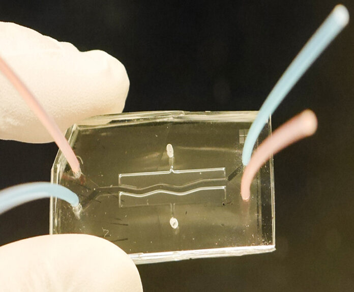 Pancreas chip y fibrosis quiística