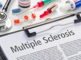 Esclerosis múltiple, mitos
