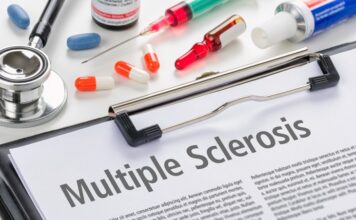 Esclerosis múltiple, mitos