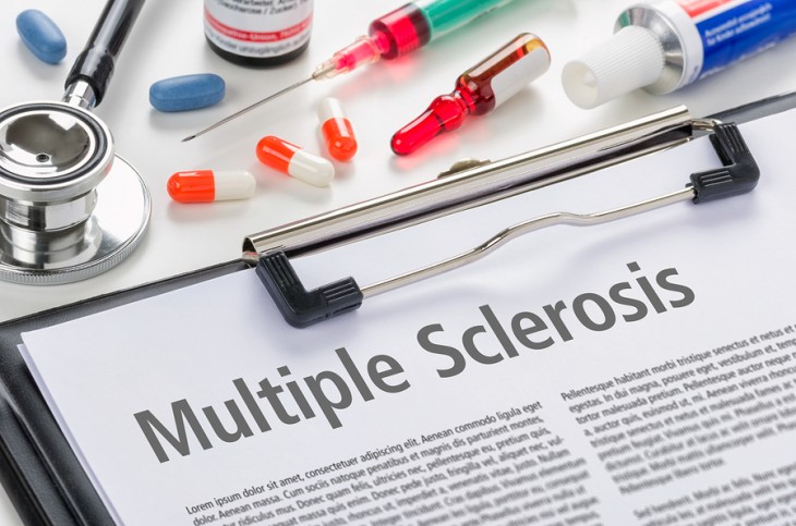 Esclerosis múltiple, mitos