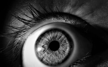 Retinitis pigmentosa