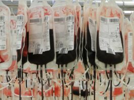 sangre, esclerodermia sistémica