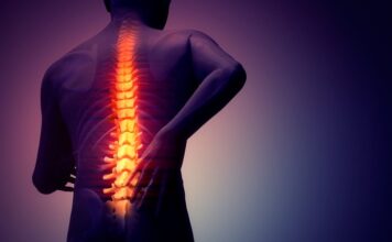 Espondilitis Anquilosante