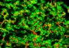 Células cancerosas cerebro ratón