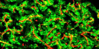 Células cancerosas cerebro ratón